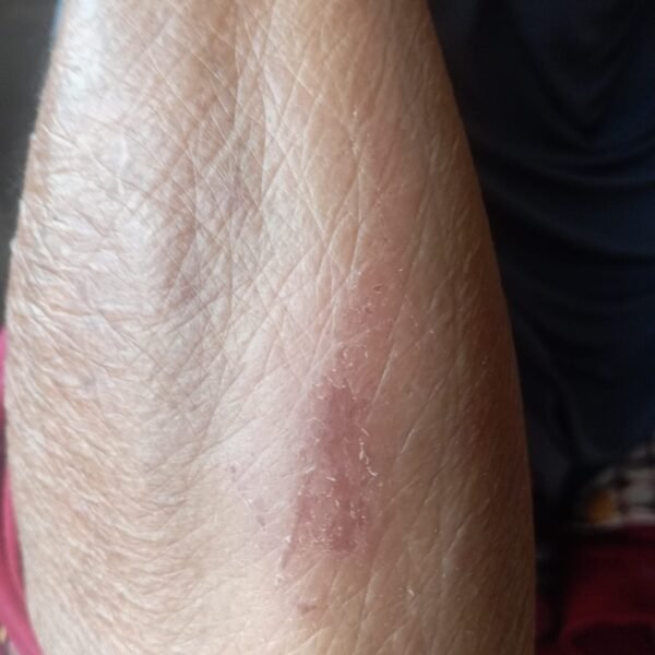 Didorong Menantu Saat Melerai Cekcok, Lansia 69 Tahun Alami Memar di Tangan