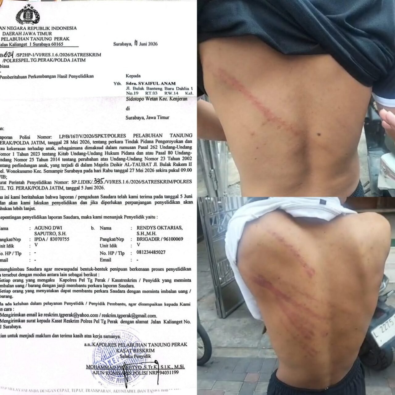 Madas Sedarah Advokasi Tiga Anak Dianiaya Bulak Rukem Surabaya