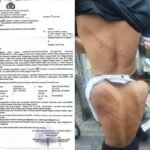 Madas Sedarah Advokasi Tiga Anak Dianiaya Bulak Rukem Surabaya